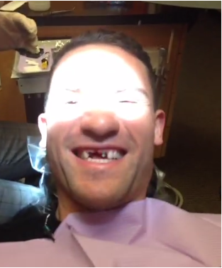 Paul Bissonnette tweets video of himself getting new teeth 