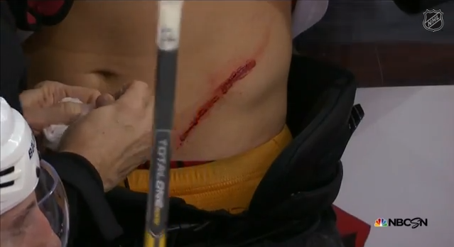 Brayden Schenn Cut